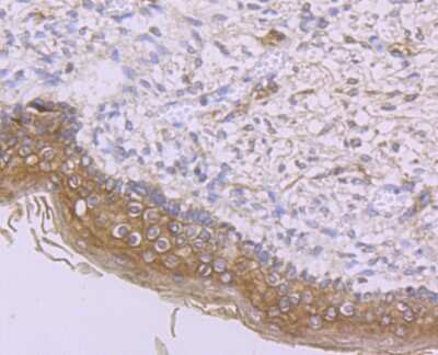 Immunohistochemistry-Paraffin: IFN-alpha/beta R1 Antibody (A5-A3) [NBP2-75534]