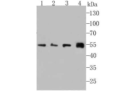 Western Blot: IFN-alpha/beta R1 Antibody (A5-A3) [NBP2-75534]