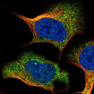 Immunocytochemistry/ Immunofluorescence: IFN-alpha/beta R1 Antibody [NBP1-83119]