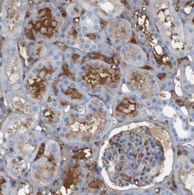 Immunohistochemistry-Paraffin: IFN-alpha/beta R1 Antibody [NBP1-83119]