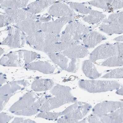 Immunohistochemistry-Paraffin: IFN-alpha/beta R1 Antibody [NBP1-83119]