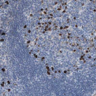 Immunohistochemistry-Paraffin: IFN-alpha/beta R1 Antibody [NBP1-83119]