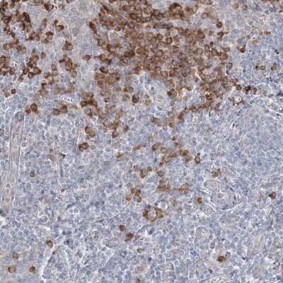 Immunohistochemistry-Paraffin: IFN-alpha/beta R1 Antibody [NBP2-38144]