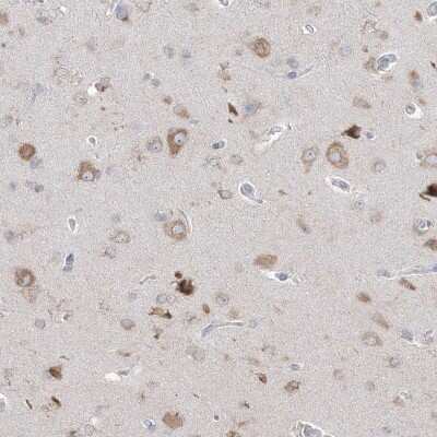 Immunohistochemistry-Paraffin: IFN-alpha/beta R1 Antibody [NBP2-38144]