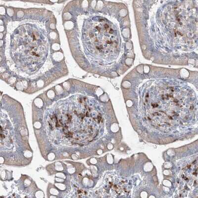 Immunohistochemistry-Paraffin: IFN-alpha/beta R1 Antibody [NBP2-38144]