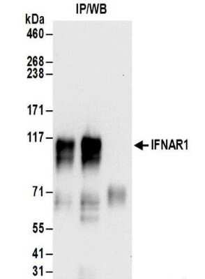 Immunoprecipitation: IFN-alpha/beta R1 Antibody [NBP2-32196]
