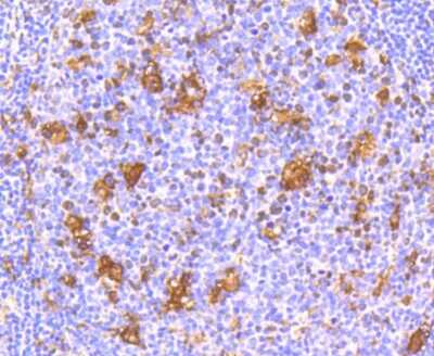 Immunohistochemistry-Paraffin: IFN-alpha/beta R1 Antibody (SR45-08) [NBP2-67339]