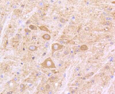 Immunohistochemistry-Paraffin: IFN-alpha/beta R1 Antibody (SR45-08) [NBP2-67339]