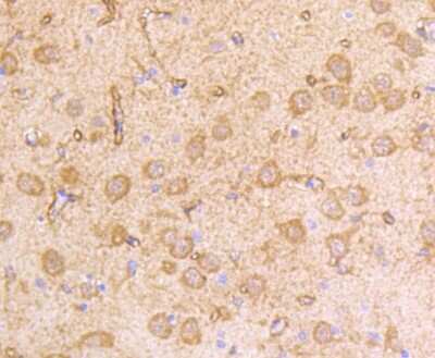 Immunohistochemistry-Paraffin: IFN-alpha/beta R1 Antibody (SR45-08) [NBP2-67339]