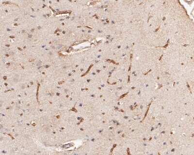 Immunohistochemistry-Paraffin: IFN-alpha/beta R1 Antibody (SR45-08) [NBP2-67339]