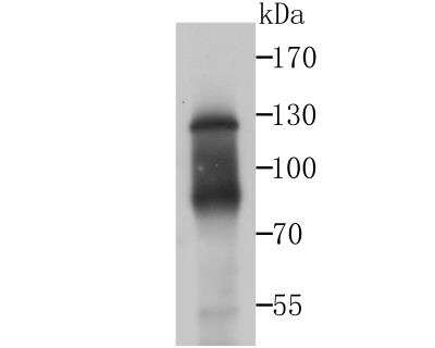 Western Blot: IFN-alpha/beta R1 Antibody (SR45-08) [NBP2-67339]