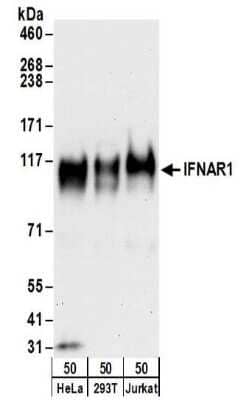 Western Blot: IFN-alpha/beta R1 Antibody [NBP2-32196]