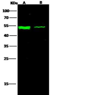 Western Blot: IFN-alpha/beta R2 Antibody (123) [NBP2-89448]