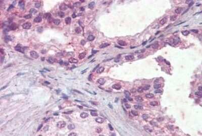 Immunohistochemistry-Paraffin: IFN-alpha/beta R2 Antibody [NBP1-20934]