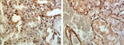 Immunohistochemistry-Paraffin: IFN-alpha/beta R2 Antibody (RM0251-5L16) - Azide and BSA Free [NBP2-11743]