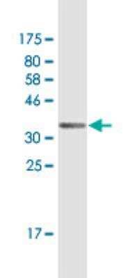 Western Blot: IFN-epsilon Antibody (2F8) [H00338376-M02]