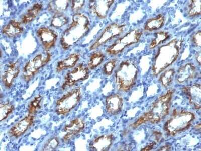 Immunohistochemistry-Paraffin: IFN-gamma Antibody (IFNG/466) - Azide and BSA Free [NBP2-54394]