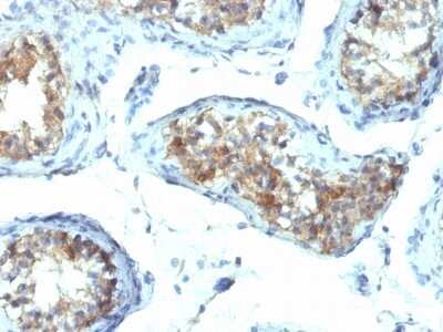 Immunohistochemistry-Paraffin: IFN-gamma Antibody (IFNG/466) - Azide and BSA Free [NBP2-54394]