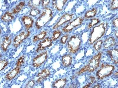 Immunohistochemistry-Paraffin: IFN-gamma Antibody (IFNG/466) [NBP2-53332]