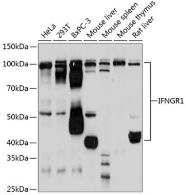 Western Blot: IFN-gamma R1/CD119 Antibody (2B9Q1) [NBP3-15421]