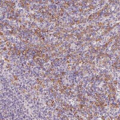 Immunohistochemistry-Paraffin: IFN-gamma R1/CD119 Antibody [NBP2-49406]