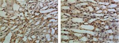 Immunohistochemistry-Paraffin: IFN-gamma R1/CD119 Antibody (RM0093-7K23) - Azide and BSA Free [NBP1-22408]