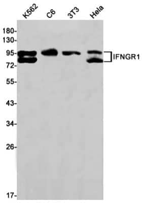 Western Blot: IFN-gamma R1/CD119 Antibody (S08-9H9) [NBP3-14884]