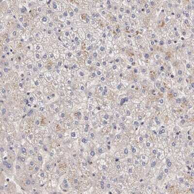 Immunohistochemistry-Paraffin: IFN-gamma R2 Antibody [NBP1-90223]