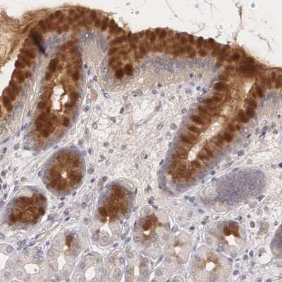 Immunohistochemistry-Paraffin: IFN-gamma R2 Antibody [NBP1-90223]