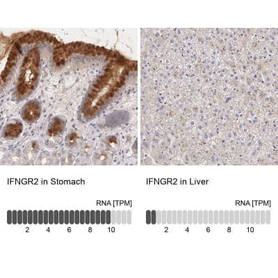 Immunohistochemistry-Paraffin: IFN-gamma R2 Antibody [NBP1-90223]