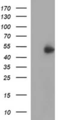 Western Blot: IFN-gamma R2 Antibody (OTI1C2)Azide and BSA Free [NBP2-71008]