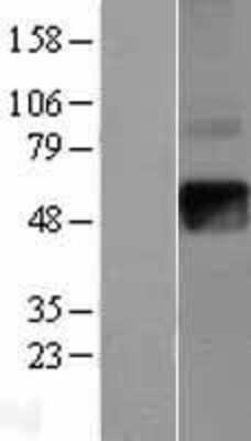 Western Blot: IFN-gamma R2 Overexpression Lysate [NBL1-11853]