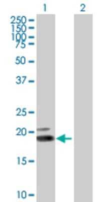 Western Blot: IFN-omega/IFNW1 Antibody [H00003467-B01P]