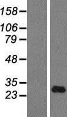 Western Blot: IFN-alpha H2/IFNA14 Overexpression Lysate [NBP2-08142]