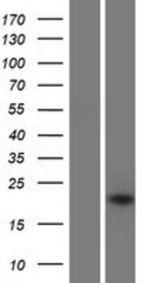 Western Blot: IFN-alpha WA/IFNA16 Overexpression Lysate [NBP2-08143]