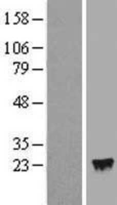 Western Blot: IFN-alpha 4 Overexpression Lysate [NBP2-06567]