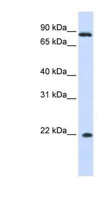 Western Blot: IFN-alpha J1/IFNA7 Antibody [NBP1-79586]