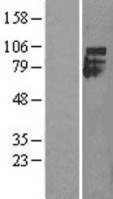 Western Blot: IFN-alpha/beta R1 Overexpression Lysate [NBP2-04169]