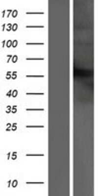 Western Blot: IFN-alpha/beta R2 Overexpression Lysate [NBP2-04481]