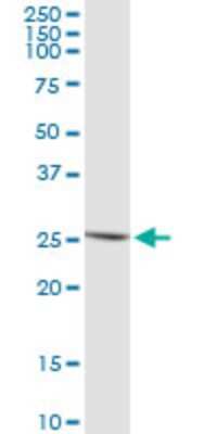 Western Blot: IFN-epsilon Antibody (3B8) [H00338376-M01]