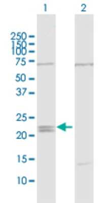 Western Blot: IFN-epsilon Antibody [H00338376-D01P]