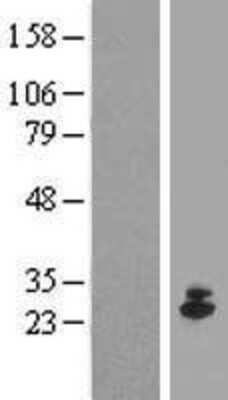 Western Blot: IFN-epsilon Overexpression Lysate [NBP2-05028]