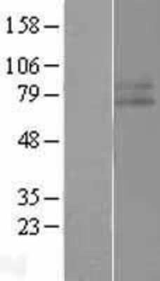 Western Blot: IFN-gamma R1/CD119 Overexpression Lysate [NBL1-11852]