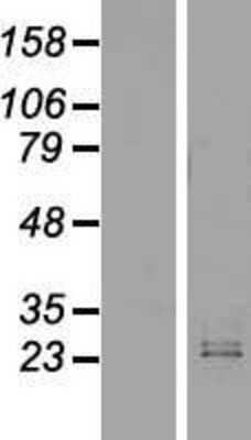 Western Blot: IFN-omega/IFNW1 Overexpression Lysate [NBP2-08140]