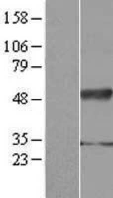 Western Blot: IFRD2 Overexpression Lysate [NBP2-07584]