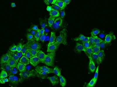 Immunocytochemistry/ Immunofluorescence: IFT122 Antibody [NBP2-97508]