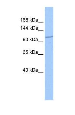 Western Blot: IFT122 Antibody [NBP1-54842]