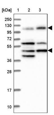 Western Blot: IFT122 Antibody [NBP1-87014]