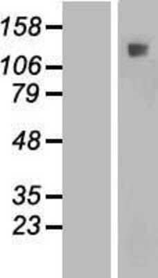 Western Blot: IFT122 Overexpression Lysate [NBL1-11856]