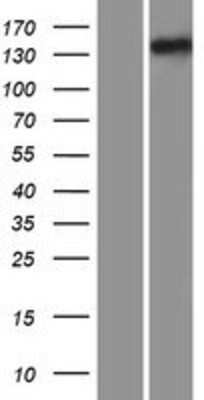 Western Blot: IFT122 Overexpression Lysate [NBP2-05830]